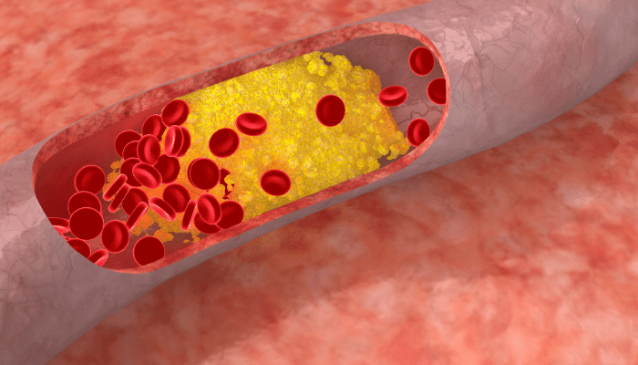 Cholesterolis